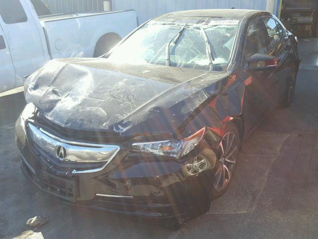 19UUB2F55FA013003 - 2015 ACURA TLX TECH BLACK photo 2