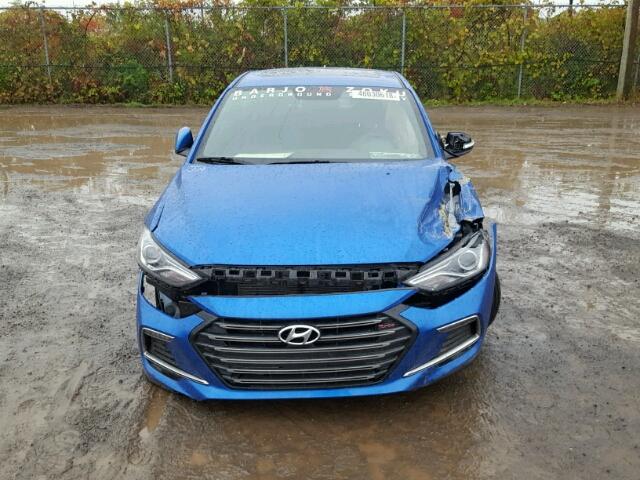 KMHD04LB3JU458479 - 2018 HYUNDAI ELANTRA SP BLUE photo 9