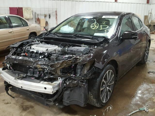 19UUB3F50FA002352 - 2015 ACURA TLX TECH BLACK photo 2