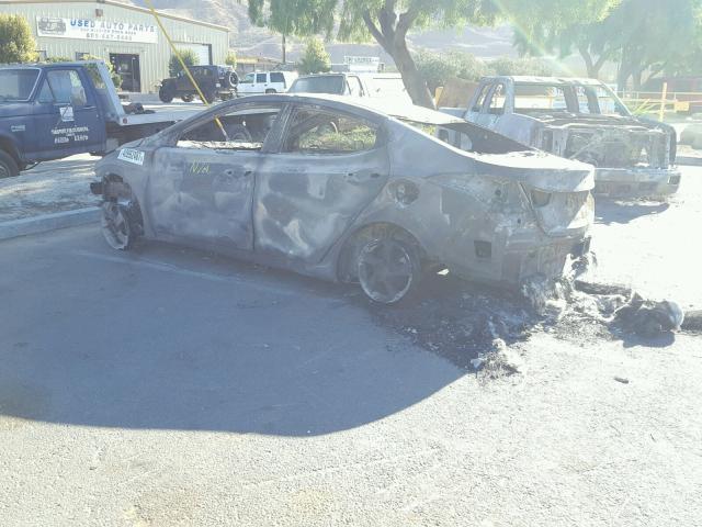 5NPDH4AE2EH486879 - 2014 HYUNDAI ELANTRA SE BURN photo 3