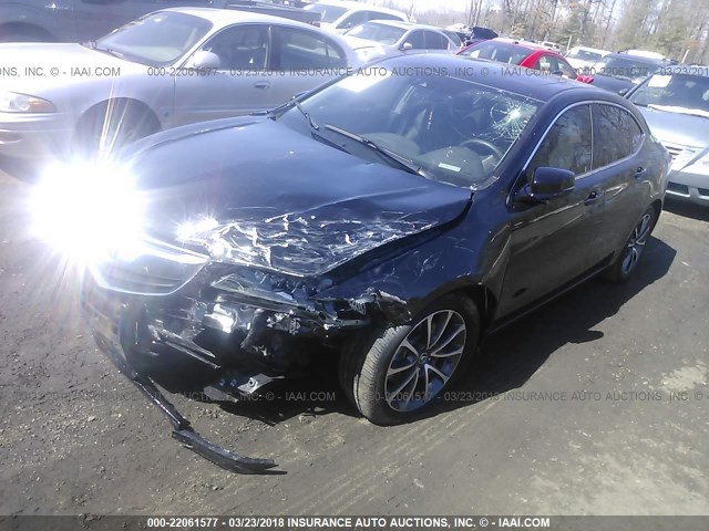 19UUB3F52HA001268 - 2017 ACURA TLX TECH BLACK photo 2