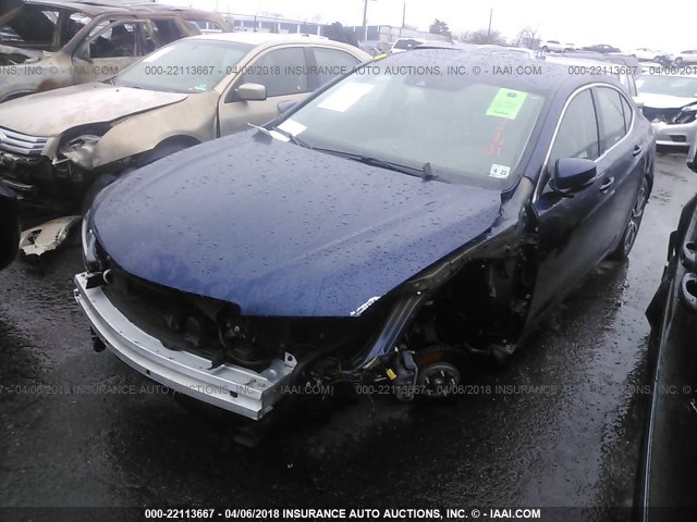 19UUB3F72HA001594 - 2017 ACURA TLX ADVANCE 蓝色 照片 2