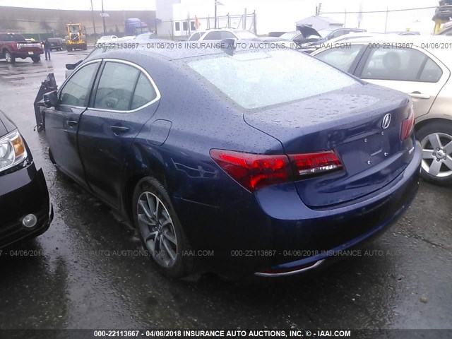 19UUB3F72HA001594 - 2017 ACURA TLX ADVANCE 蓝色 照片 3