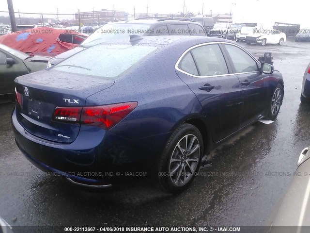 19UUB3F72HA001594 - 2017 ACURA TLX ADVANCE 蓝色 照片 4