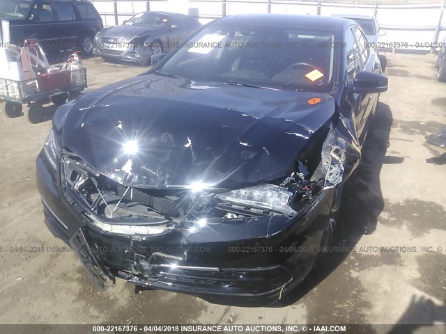 19UUB2F59FA007947 - 2015 ACURA TLX TECH BLACK photo 6