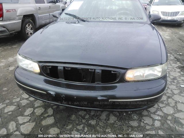 2G4WY55J411158974 - 2001 BUICK CENTURY LIMITED BLACK photo 6