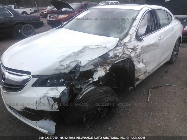 19UUB3F53FA001910 - 2015 ACURA TLX TECH WHITE photo 6
