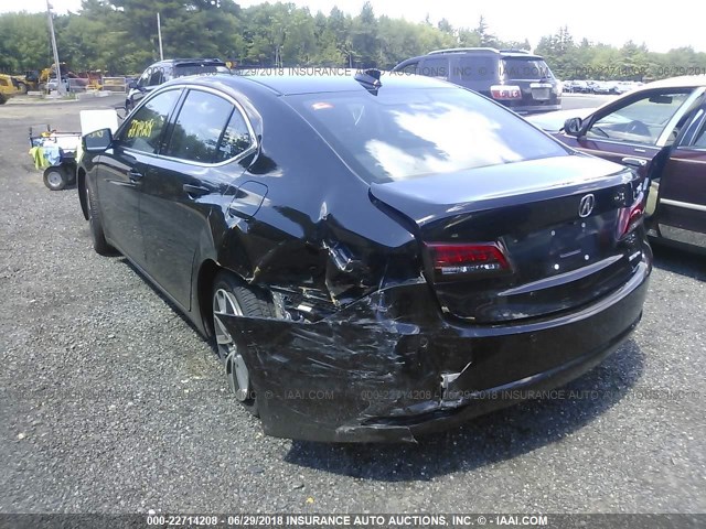 19UUB3F77FA003435 - 2015 ACURA TLX ADVANCE შავი ფოტო 3