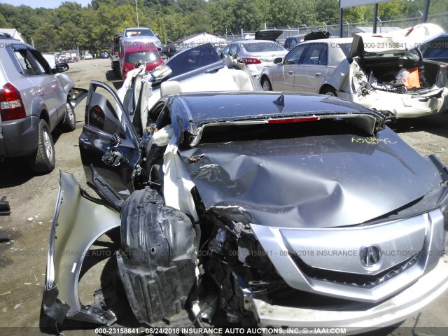 19UUA86579A012140 - 2009 ACURA TL GRAY photo 6