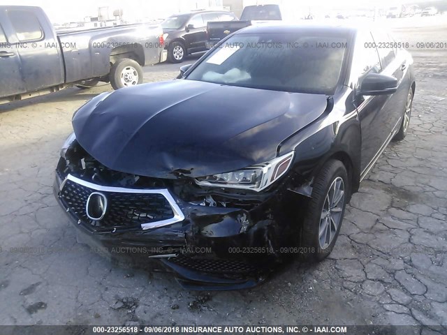19UUB1F58JA001883 - 2018 ACURA TLX TECH BLACK photo 2