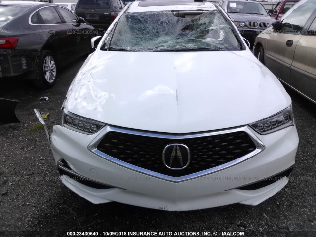 19UUB1F5XJA005983 - 2018 ACURA TLX TECH თეთრი ფოტო 6